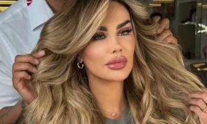 Ninel se somete a cirugía para cambiar el color de sus ojos